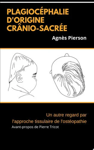 Cover of Plagiocéphalie d'origine crânio-sacrée: un autre regard par l'approche tissulaire de l'ostéopathie